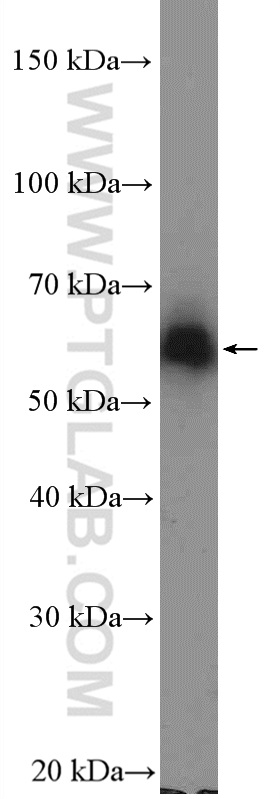ZNF382 Polyclonal antibody