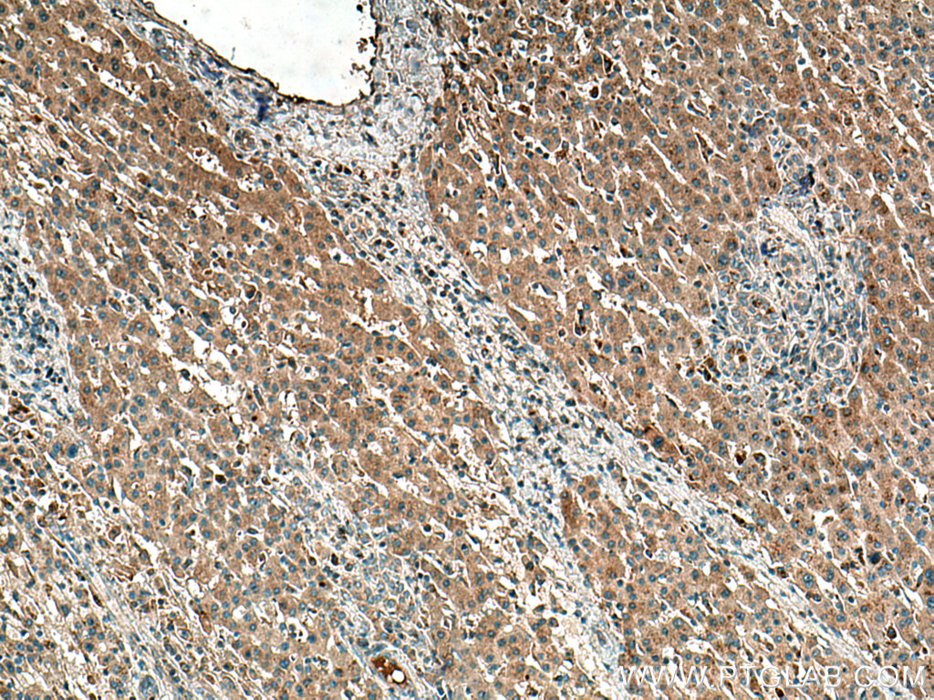 ATG101 Polyclonal antibody