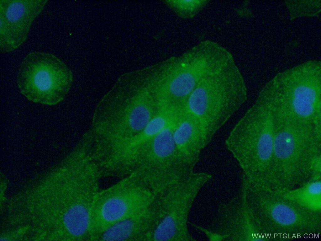 CD55 Polyclonal antibody