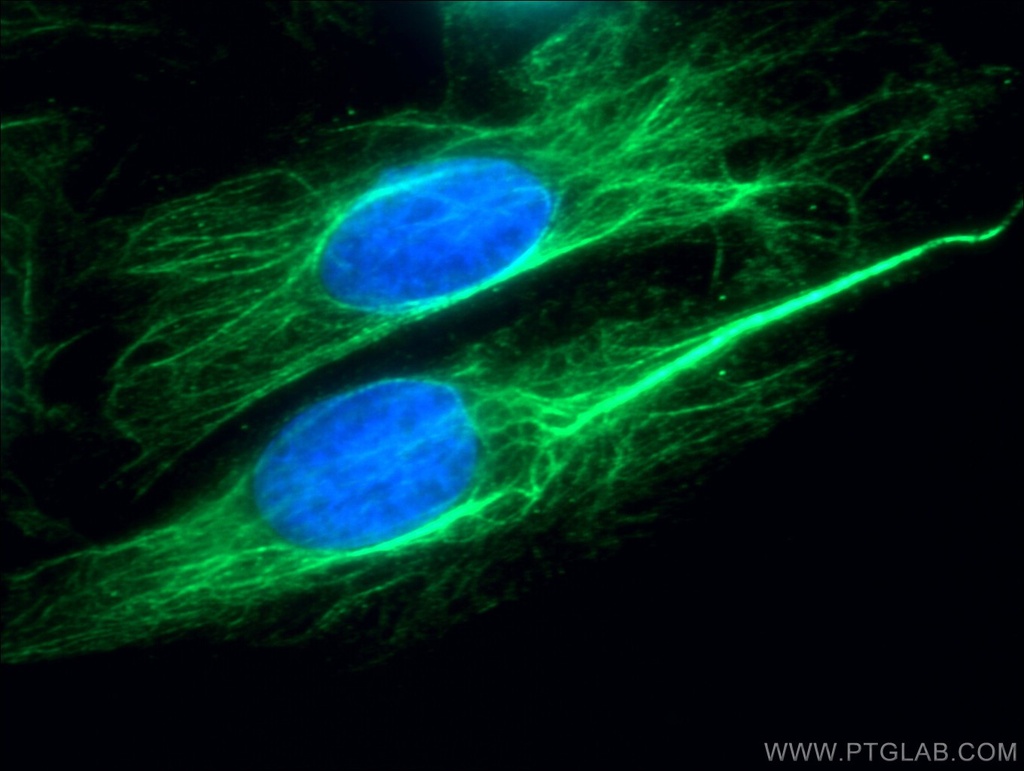 p70(S6K) Polyclonal antibody