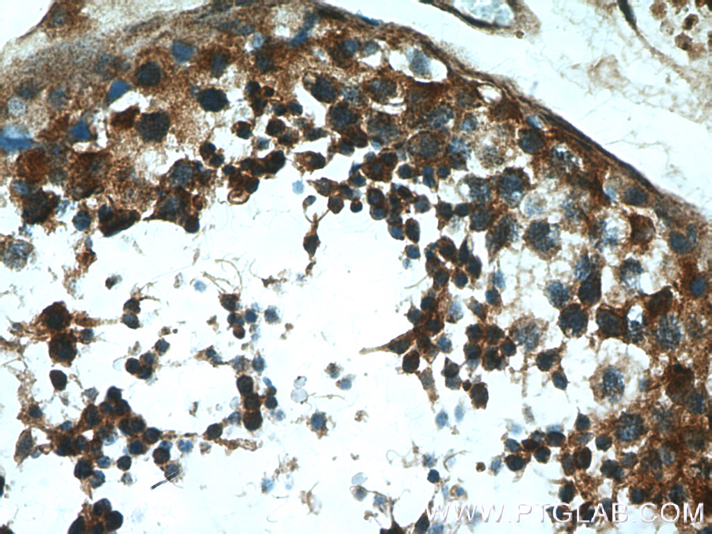 MAEL Polyclonal antibody