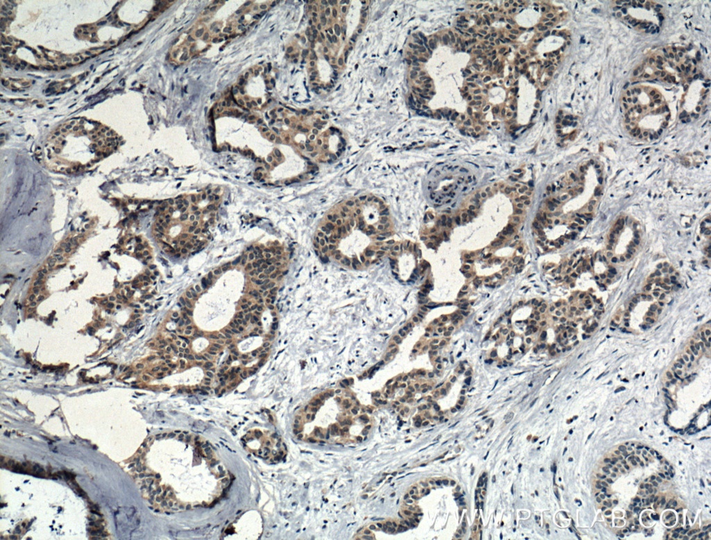 IL-5 Polyclonal antibody