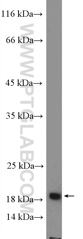 SSPN Polyclonal antibody