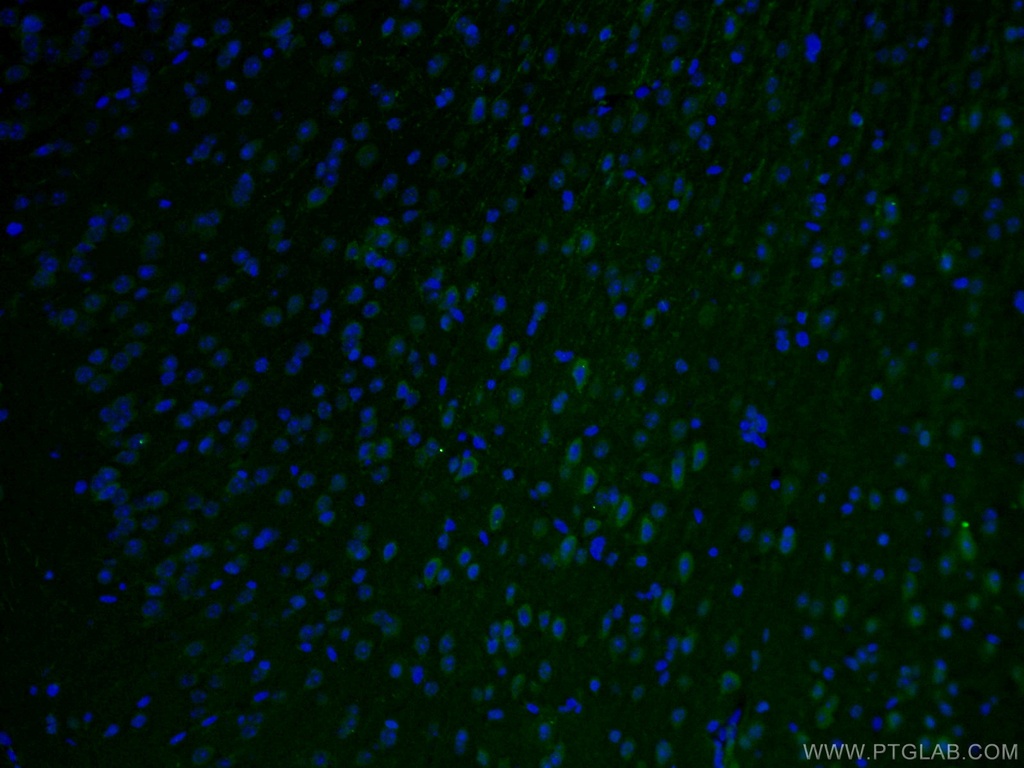 STX5 Polyclonal antibody