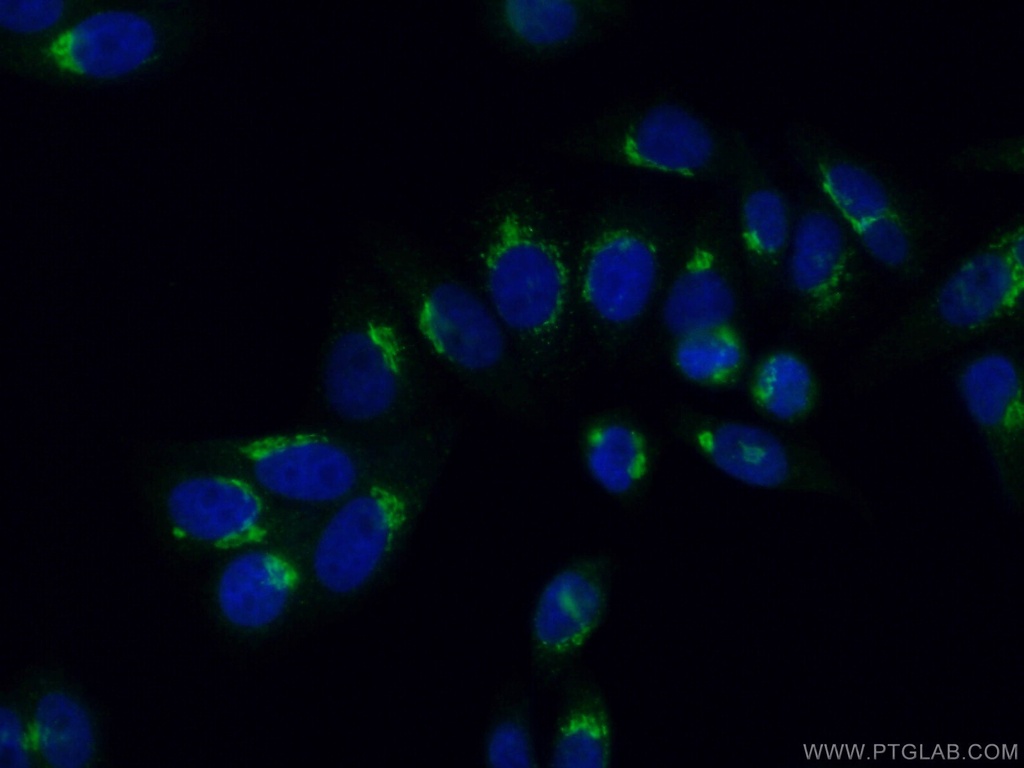 NUCB2/nesfatin-1 Polyclonal antibody