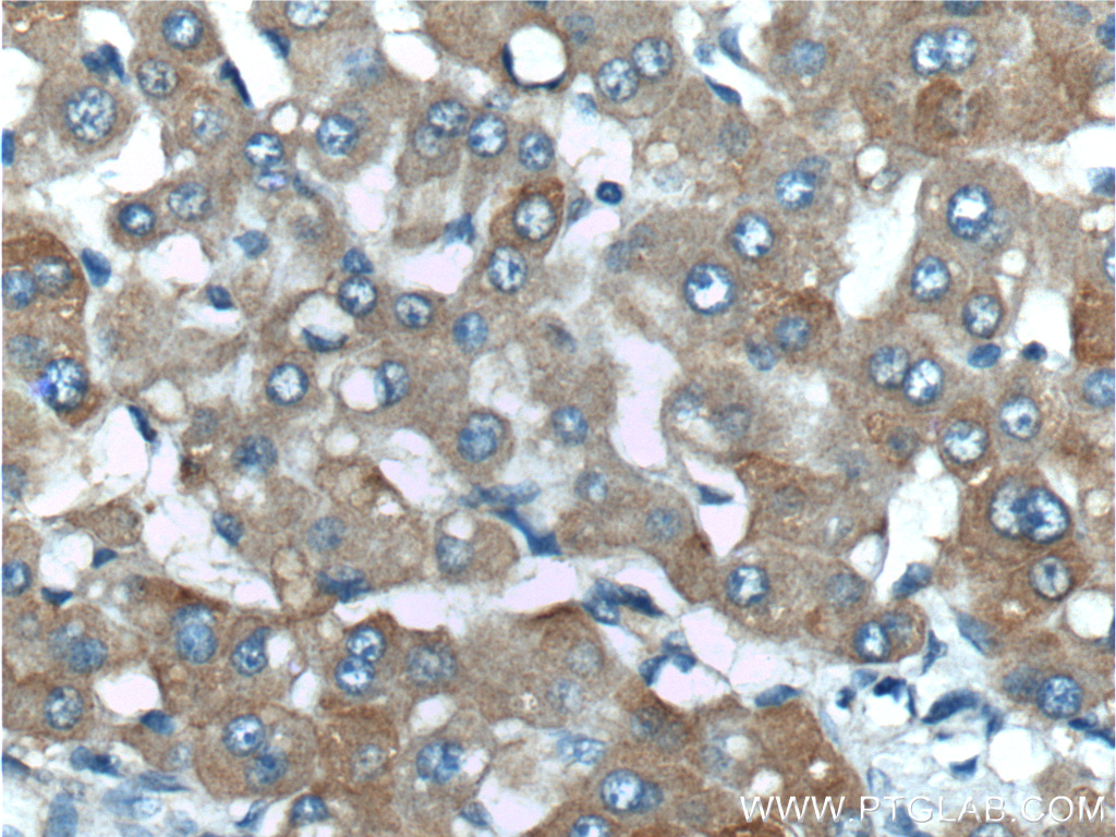 ENTPD5 Polyclonal antibody