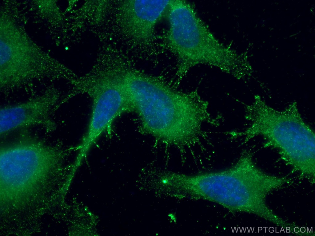 SUFU Polyclonal antibody