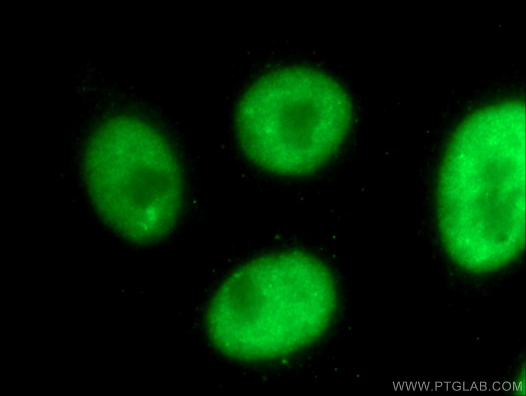 HNRPLL Polyclonal antibody