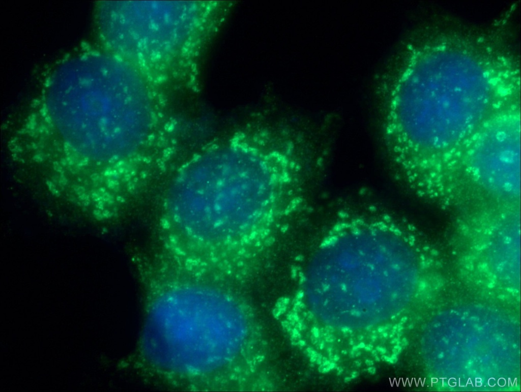 GPSM2 Polyclonal antibody
