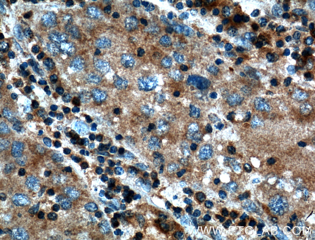 SAMD8 Polyclonal antibody