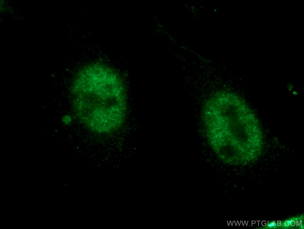 CDK12/CRKRS Polyclonal antibody