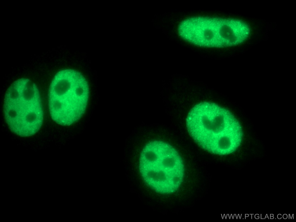 CstF-64 Polyclonal antibody