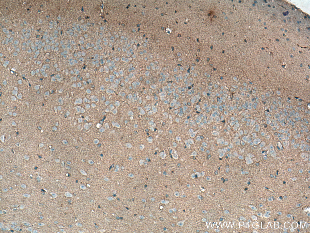 ADAMTS7 Polyclonal antibody