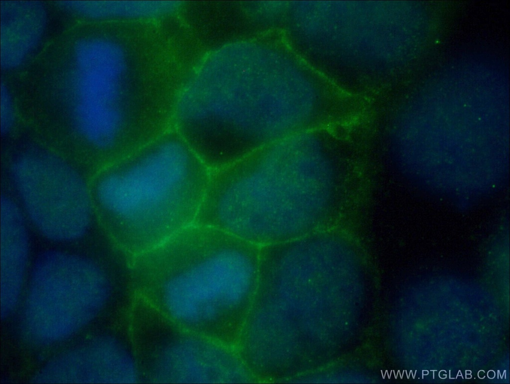 FLVCR1 Polyclonal antibody