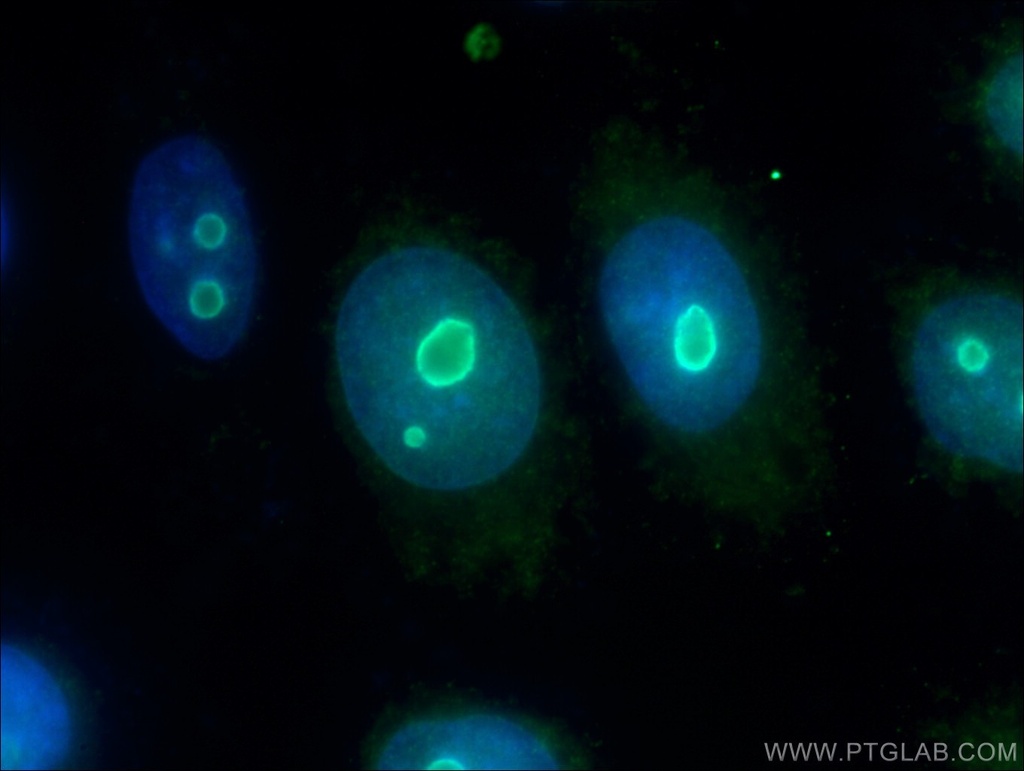 NOP14 Polyclonal antibody