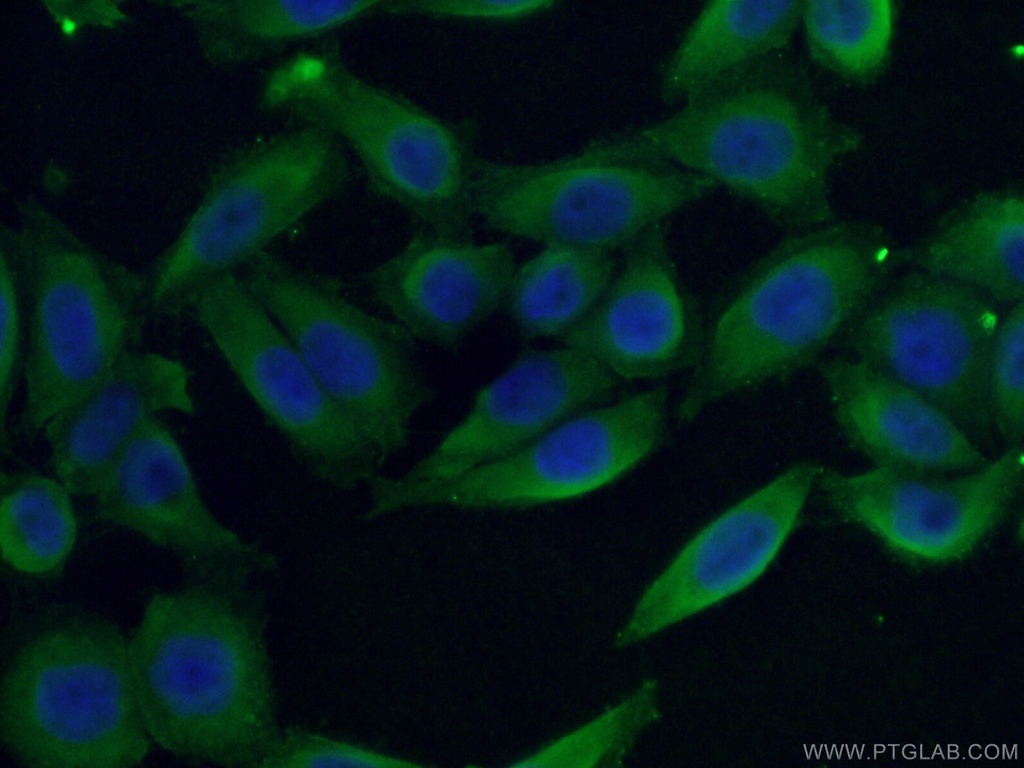 LTBP1 Polyclonal antibody