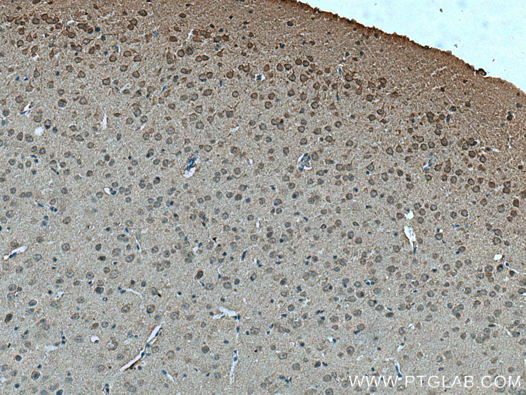 MYO9A Polyclonal antibody