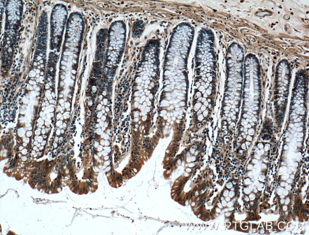 IFT22 Polyclonal antibody