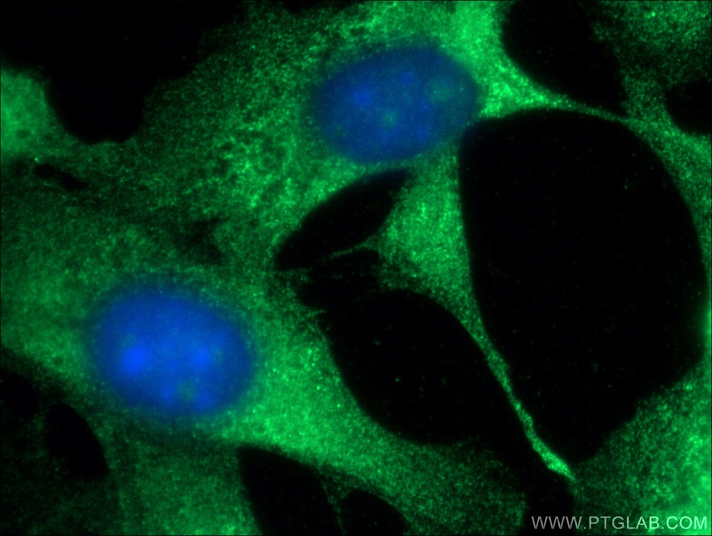 PKC Zeta Polyclonal antibody