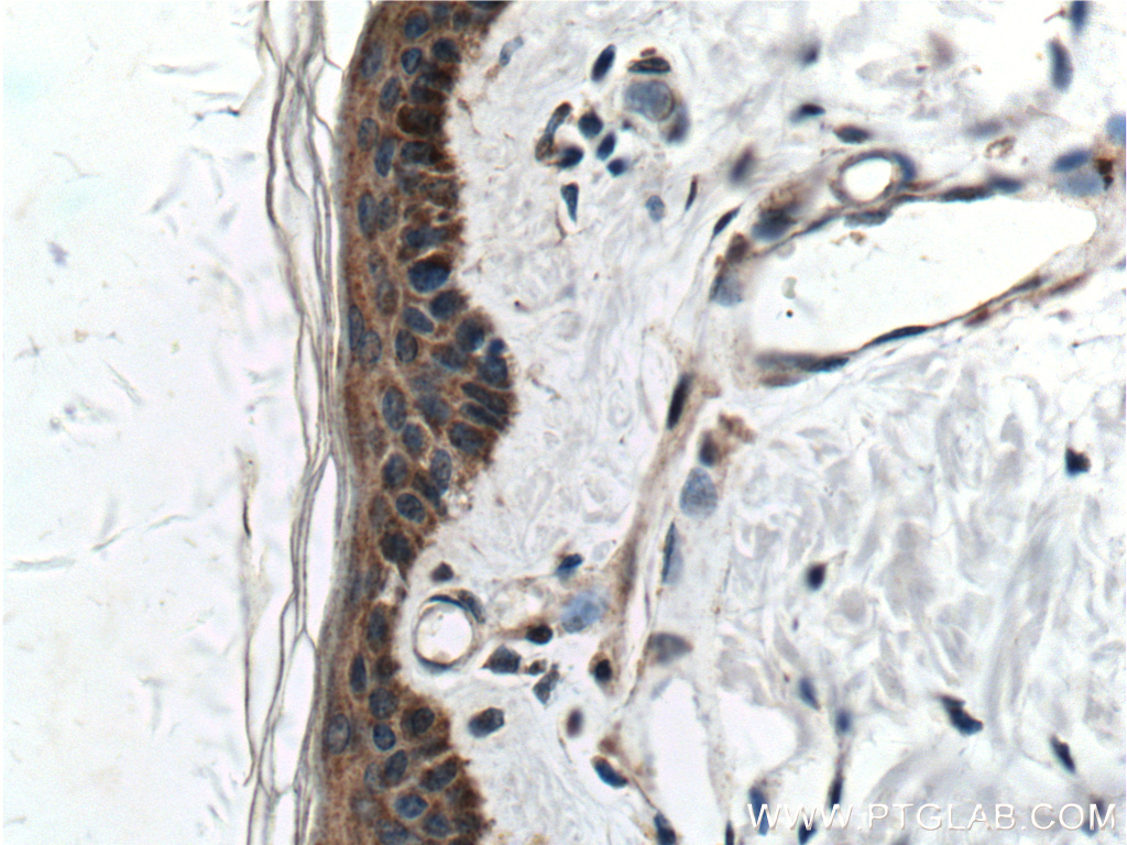 Integrin Beta 1 Polyclonal antibody