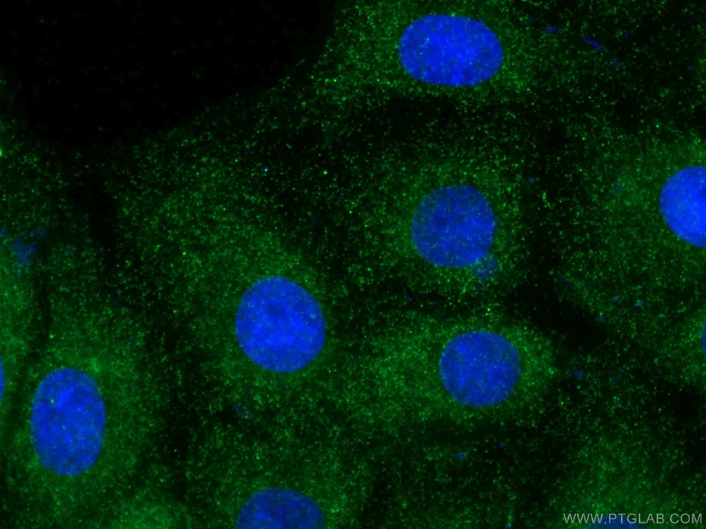 Fibrillin 1  Polyclonal antibody