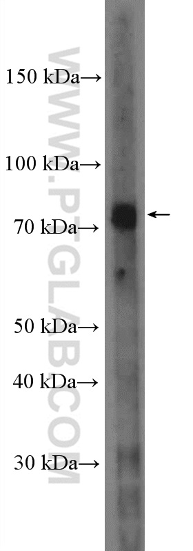 MTRR Polyclonal antibody