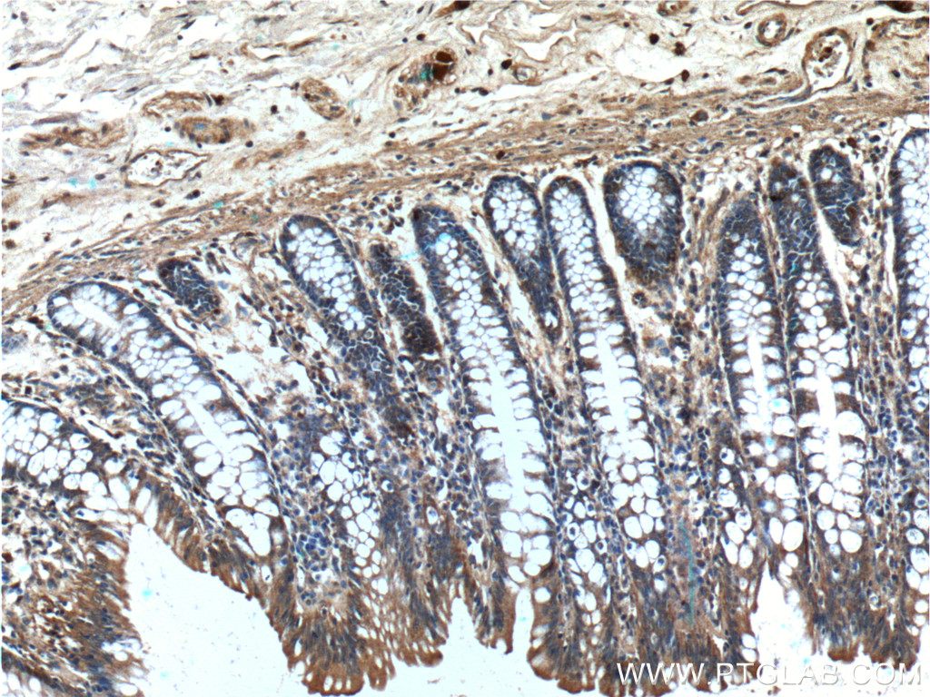 PAM Polyclonal antibody