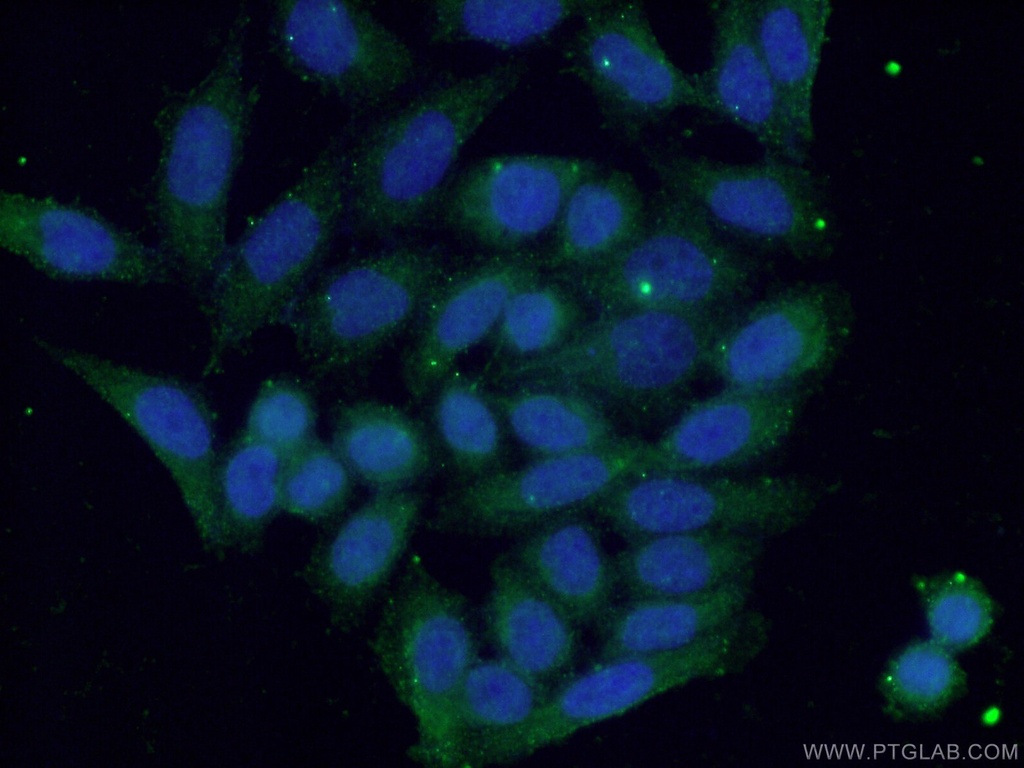 S100A9 Polyclonal antibody