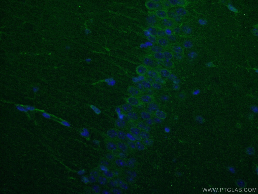WFS1 Polyclonal antibody