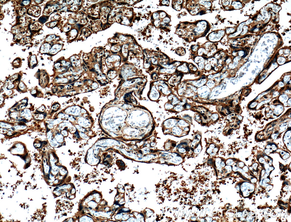 CRELD2 Polyclonal antibody