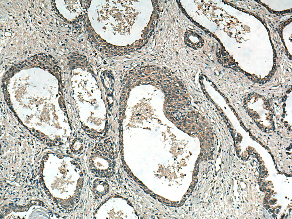 RNF113A Polyclonal antibody