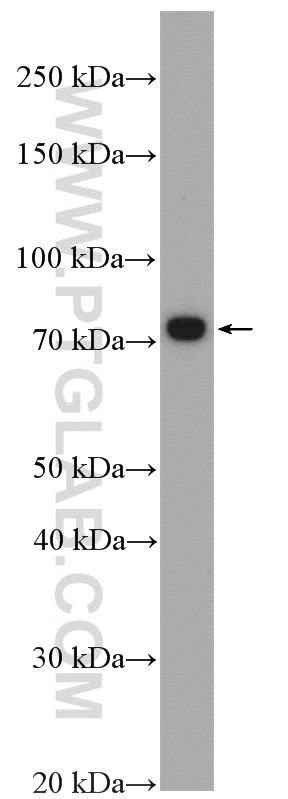 ERCC6L2 Polyclonal antibody