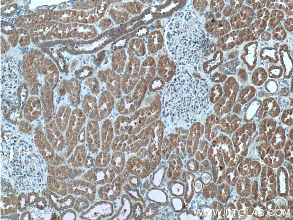 PI3 Kinase p55 Gamma Polyclonal antibody