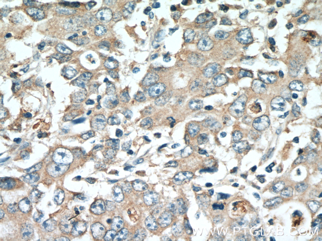 DMBT1 Polyclonal antibody