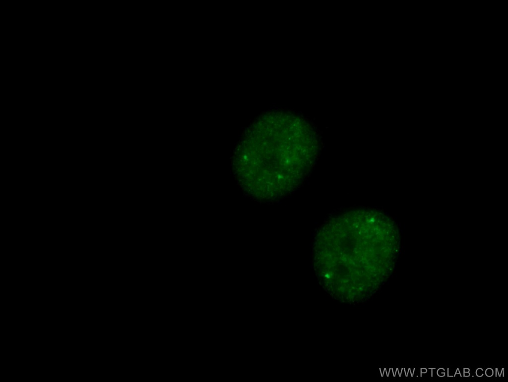 CCDC124 Polyclonal antibody
