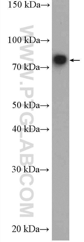 SHCBP1L Polyclonal antibody