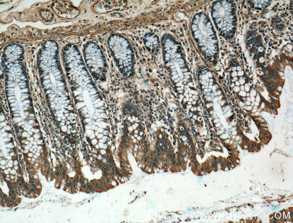 CARMIL Polyclonal antibody
