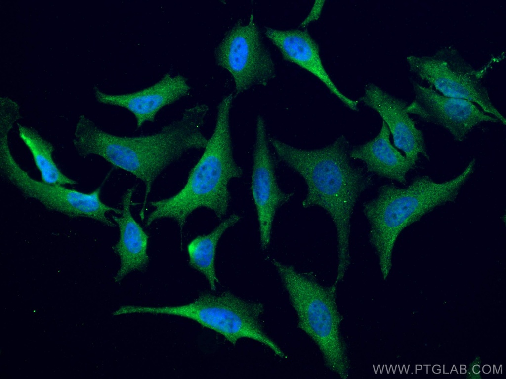 ATM Polyclonal antibody