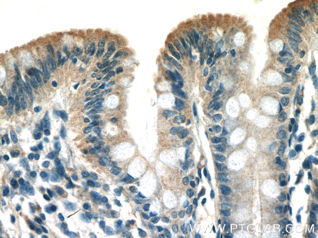 ST14 Polyclonal antibody