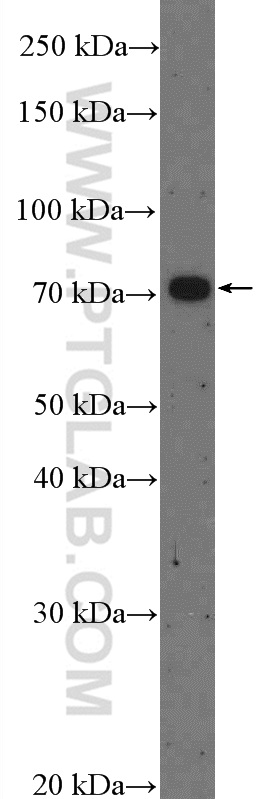 ZDHHC8 Polyclonal antibody