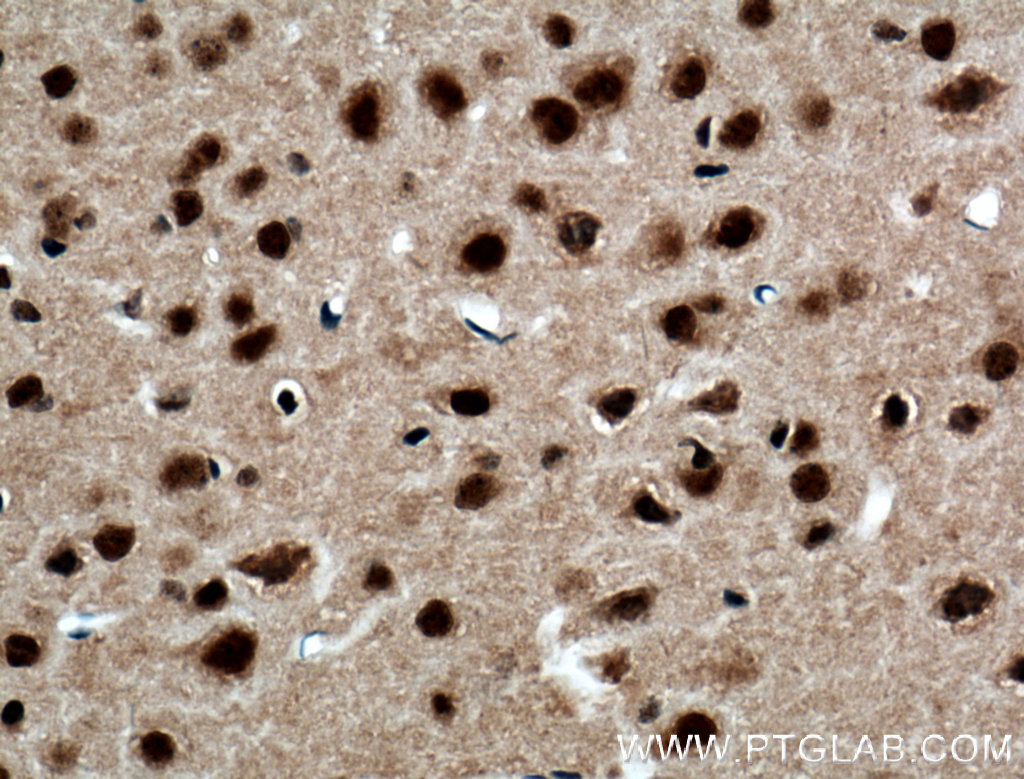 FTO Polyclonal antibody