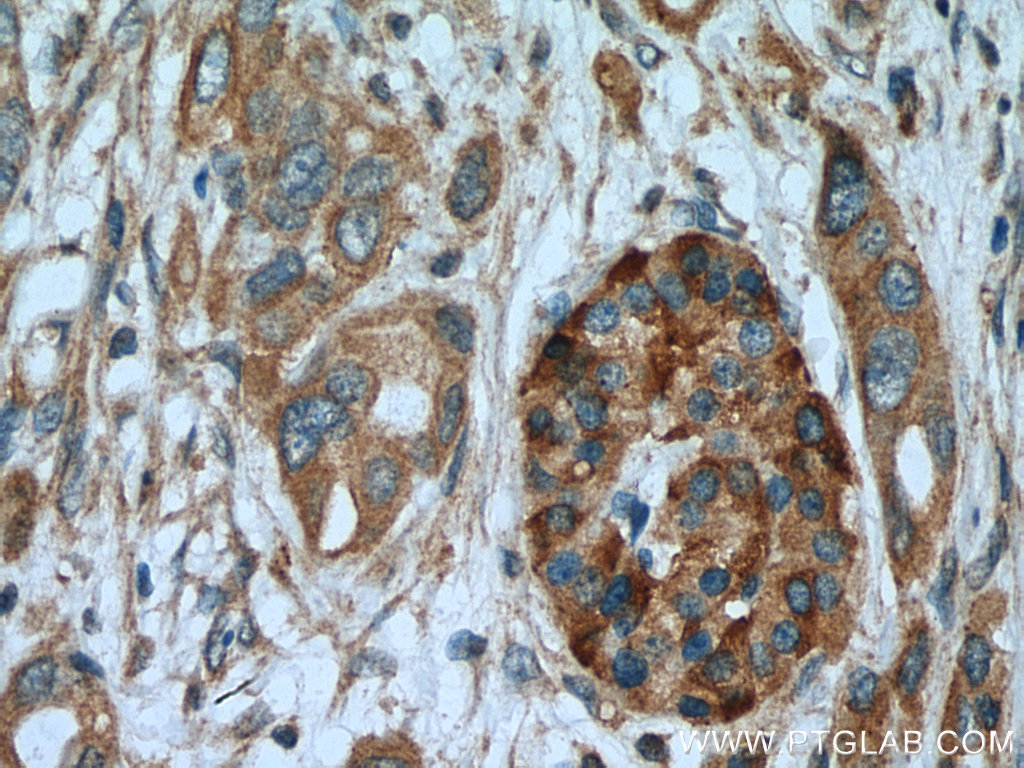 ASIC1 Polyclonal antibody