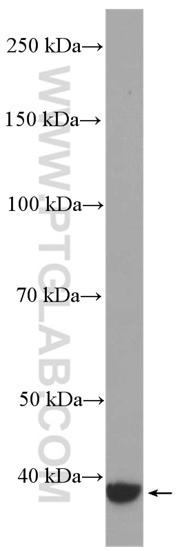 GNAQ Polyclonal antibody