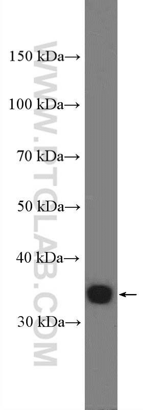 KCTD10 Polyclonal antibody