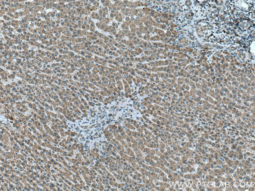 Chordin Polyclonal antibody