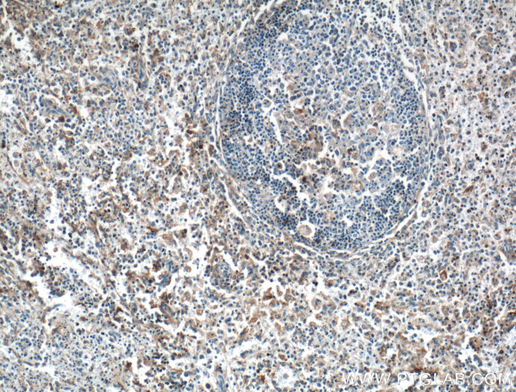 GBP2 Polyclonal antibody