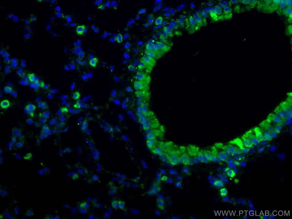 COX2/ Cyclooxygenase 2/ PTGS2 Polyclonal antibody