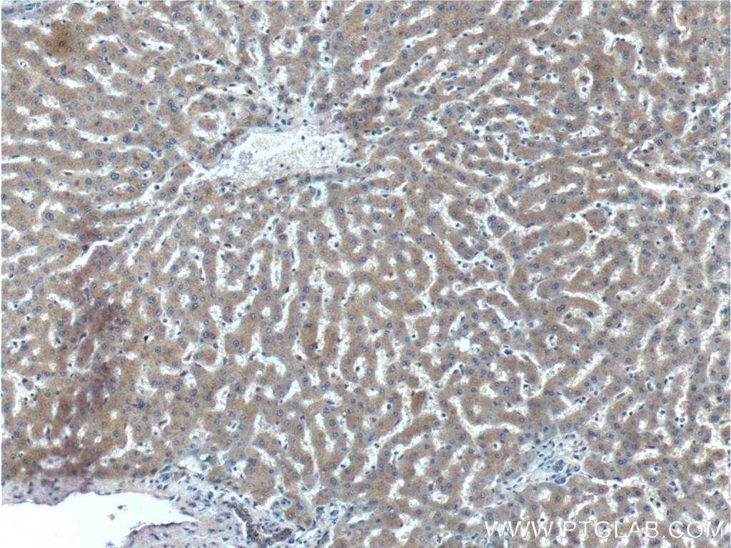 STAMBPL1 Polyclonal antibody