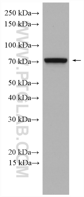 IFT74 Polyclonal antibody