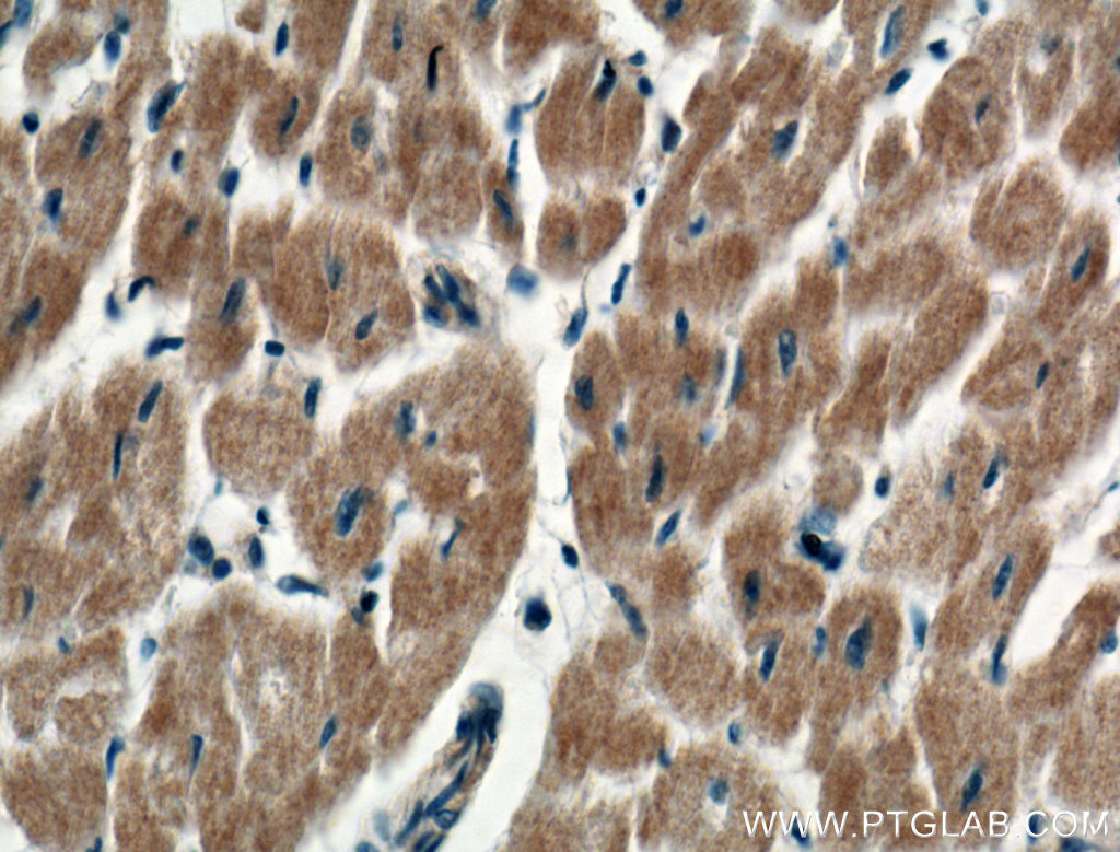 RARS Polyclonal antibody